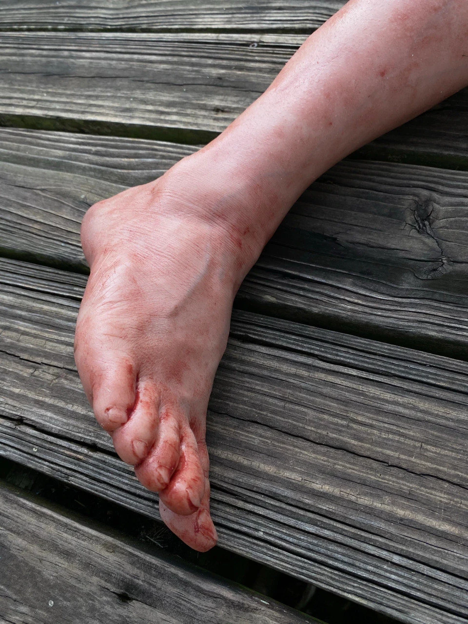 Male Large Leg 3 Male Large Leg