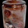 Decayed Foot In The Jar