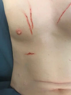 Trauma Torso Skin -Bloodline Effects Store 60a069 baf8fbeb1b6a4ae9af15f52ee5ae3391mv2