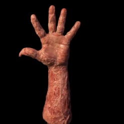 Burned Victim Arm