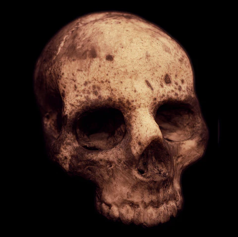 Custom Jawless Skull 3 Custom Jawless Skull